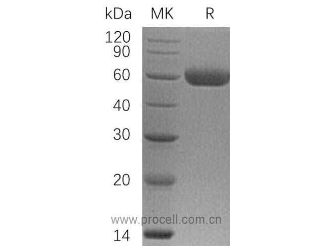 OPG/ TNFRSF11B (C-6His), Human, Recombinant