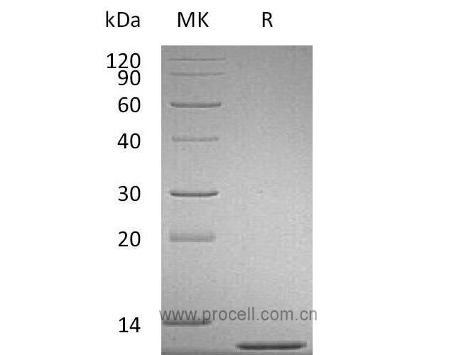 MCP-1/ CCL2, Mouse, Recombinant
