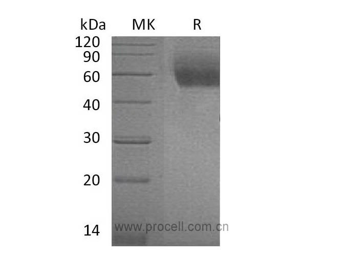 IL-1RL1/ IL-1 R4 (C-6His), Mouse, Recombinant