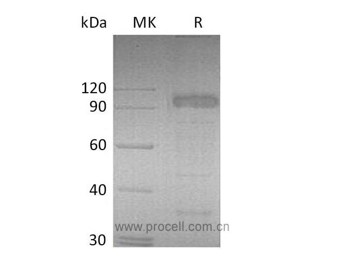IL-23R (C-Fc), Mouse, Recombinant
