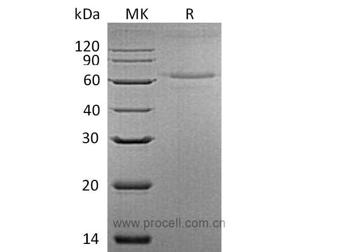 IL-27 (C-6His), Mouse, Recombinant