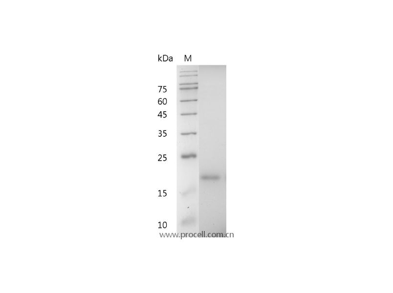 IL-33/IL-1 F11/NF-HEV, Mouse, Recombinant