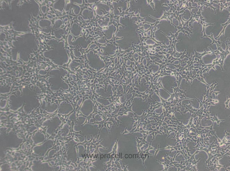 293A (人胚肾细胞) (STR鉴定正确)