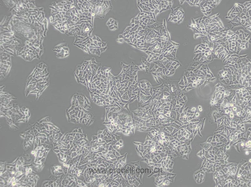 BEL-7402 (人肝癌细胞) (Hela污染细胞系，暂不供应)