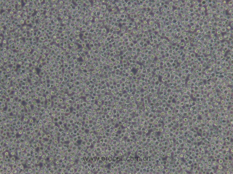 CA46 (人Burkitt's淋巴瘤细胞) (STR鉴定正确)