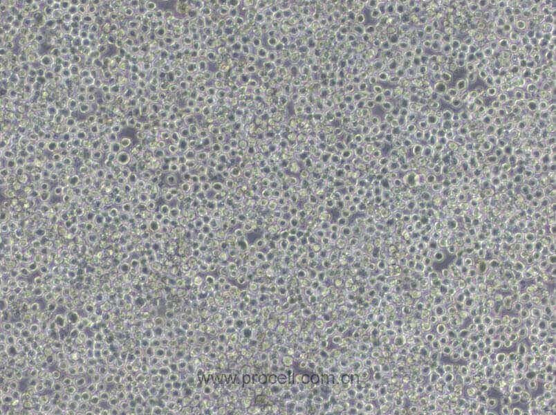 EL4 (小鼠淋巴瘤细胞) (种属鉴定正确)