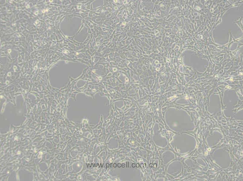 HBL-100 (人整合SV40基因的乳腺上皮细胞) (STR鉴定正确)