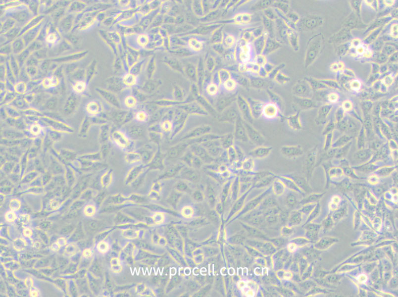 NCI-H157 (人非小细胞肺腺癌细胞) (STR鉴定正确)