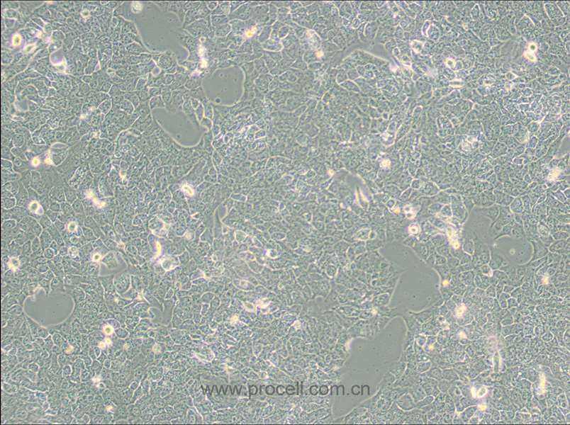 NCI-H2228 [H2228; H-2228] (人肺癌细胞) (STR鉴定正确)