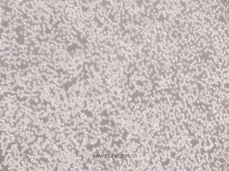 NALM-6 (人B淋巴白血病细胞) (STR鉴定正确)