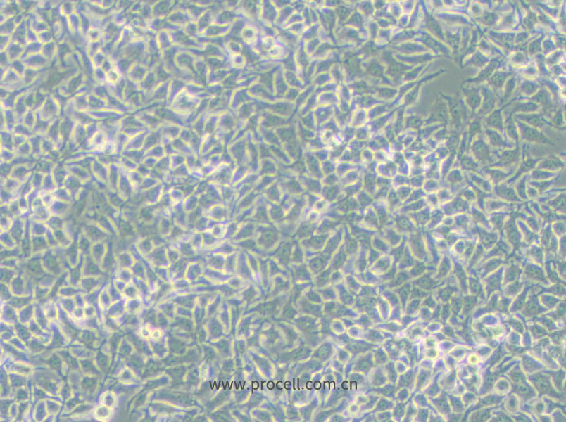 NCI-H3122 (人非小细胞肺癌细胞) (STR鉴定正确)