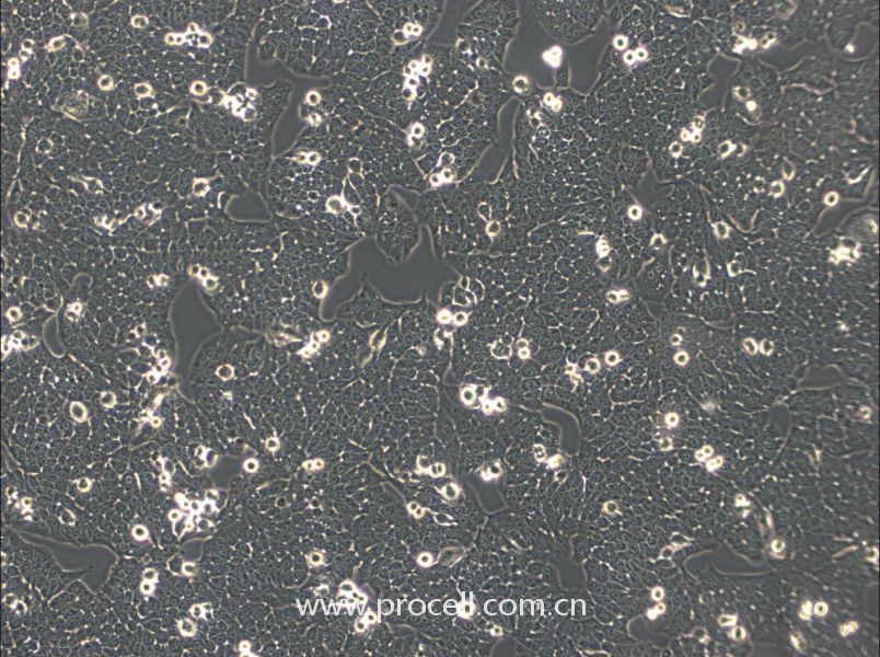 WSU-HN30 (人口腔鳞状细胞) (STR鉴定正确)