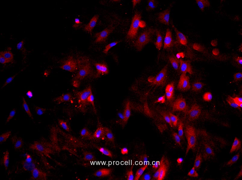大鼠视网膜Muller细胞