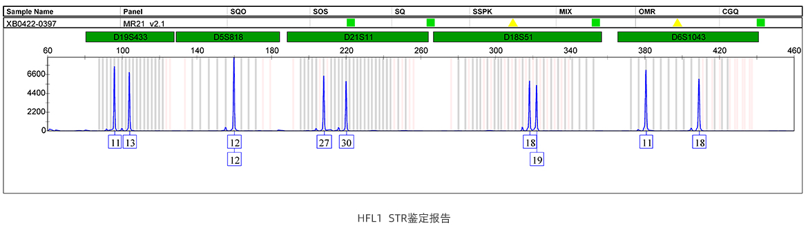 HFL1  STR鉴定报告