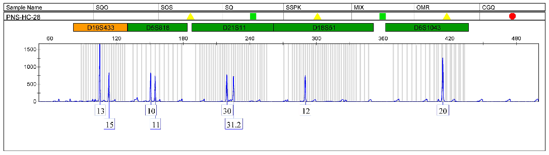 CFPAC-1细胞STR鉴定图谱
