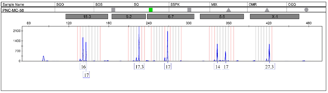 GC-2spd(ts)细胞STR鉴定图谱