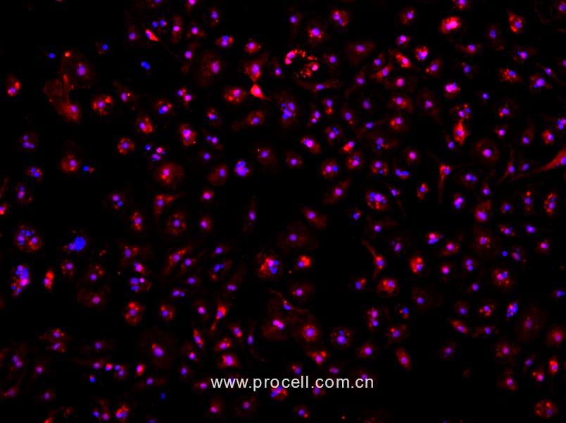 小鼠骨髓来源内皮祖细胞