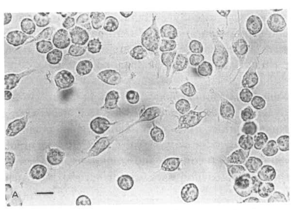 BV2细胞显微照片，bar=30 μm