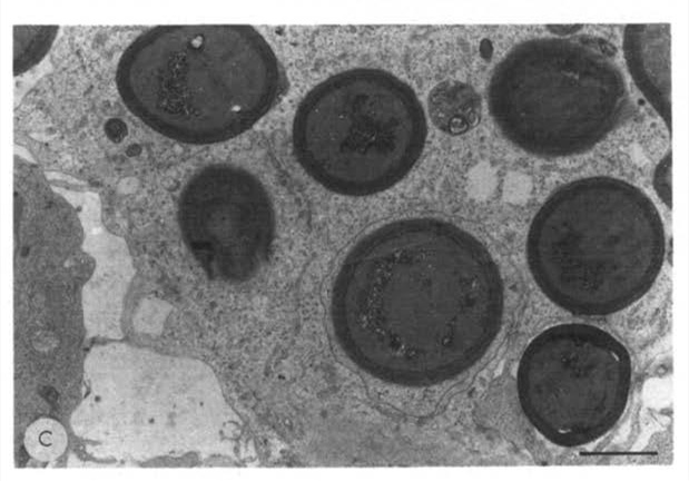 通过透射电镜观察，BV2细胞的部分细胞质吞噬iCA，bar=3 μm