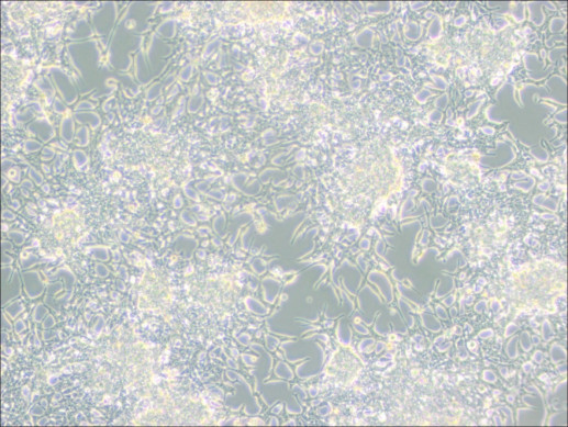聚集生长的LNCaP Clone FGC细胞