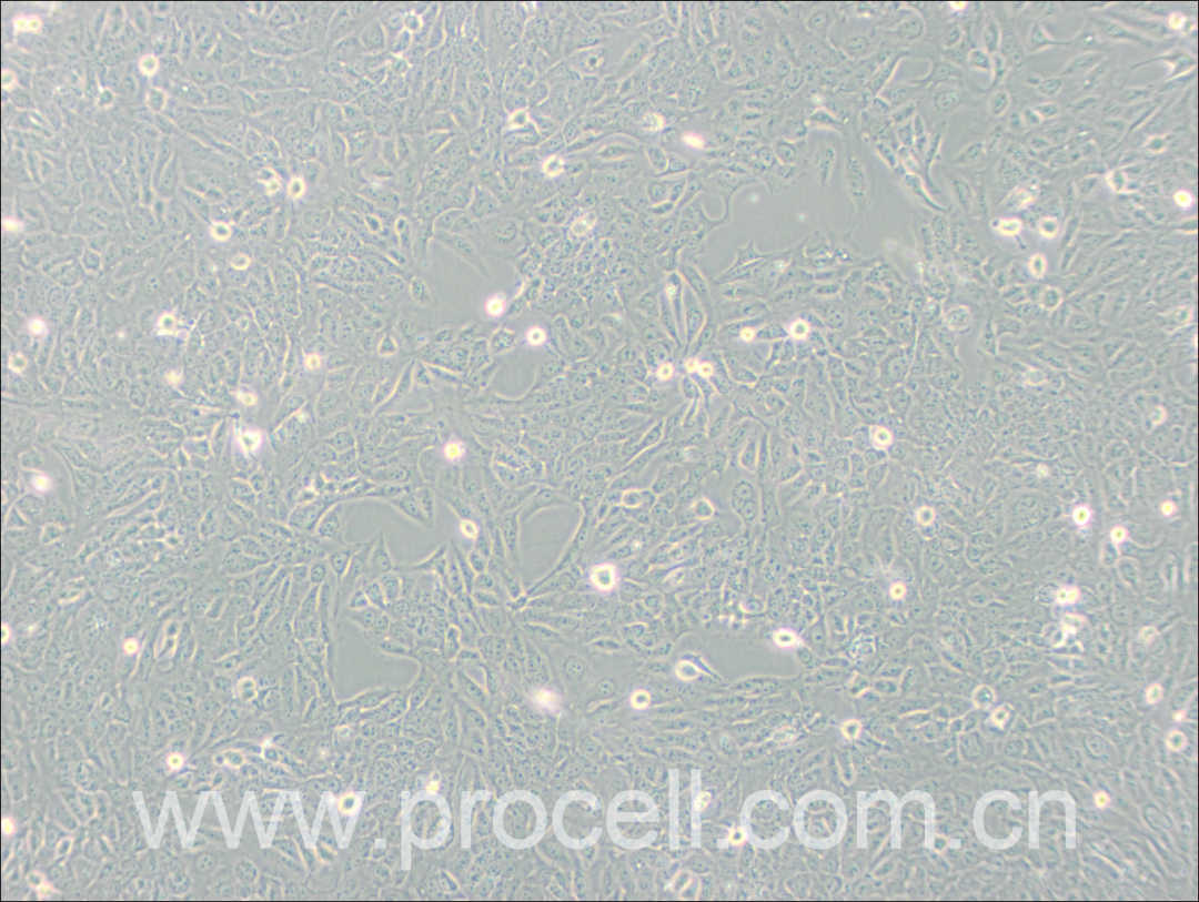 SV-HUC-1细胞正常生长