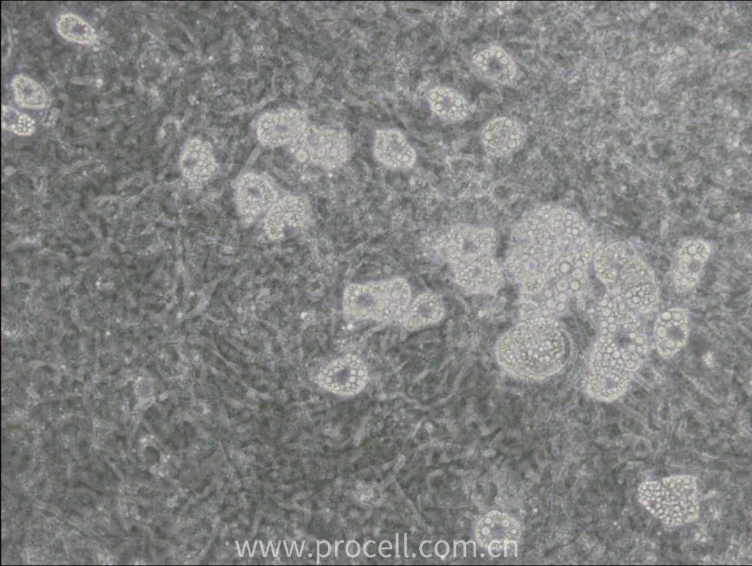 3T3-L1细胞常规培养