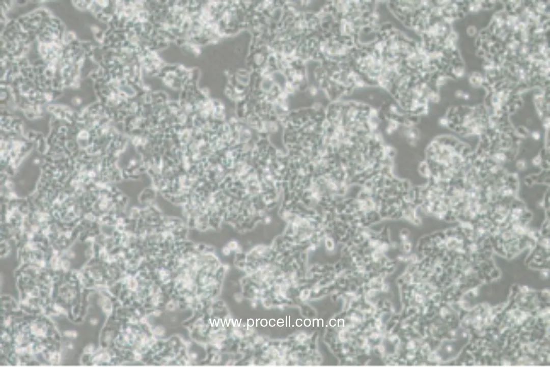 NCl-H520细胞密度