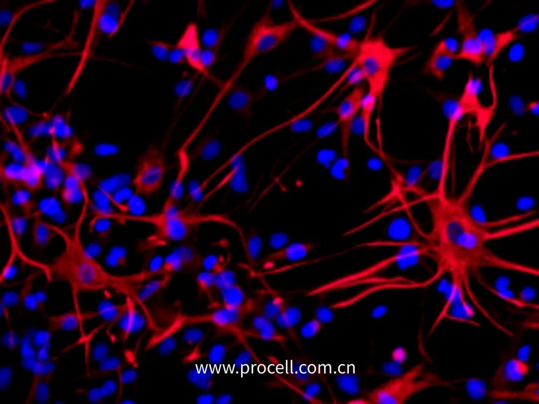 普诺赛提取的大鼠神经星形胶质细胞鉴定图