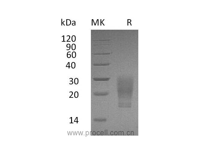 GM-CSF/ CSF2 (C-6His, Cells), Human, Recombinant