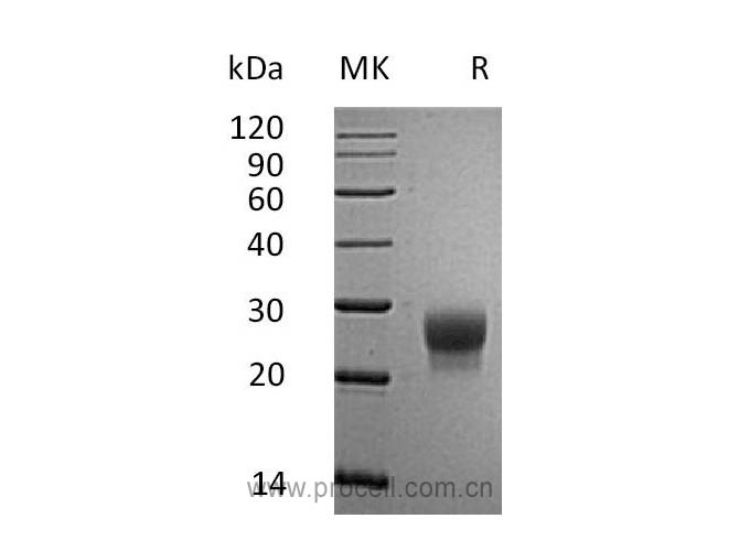 G-CSF/ CSF3 (C-6His), Mouse, Recombinant