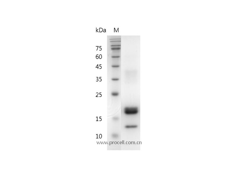 M-CSF/ CSF1 (C-6His), Human, Recombinant