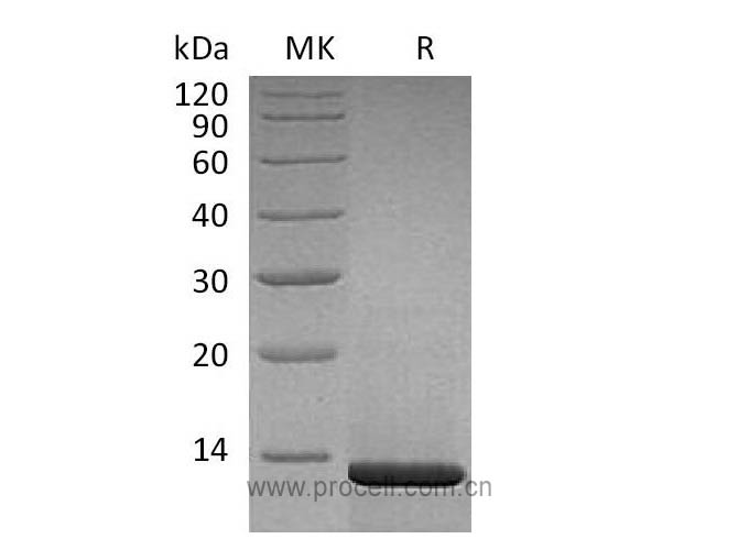 β-NGF/ NGF/ NGFB (Ser122-Arg239, Cells), Human, Recombinant