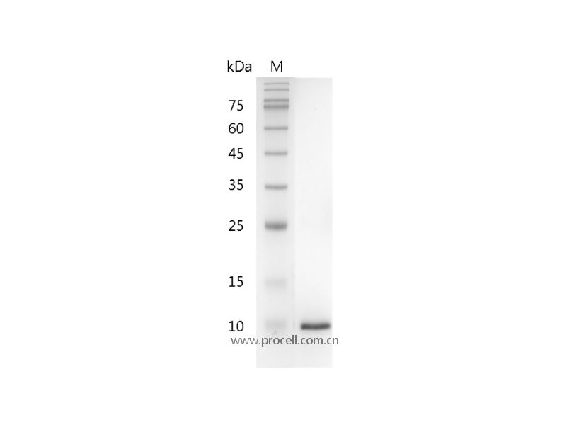 β-NGF/ NGF/ NGFB (Met130-Arg239), Mouse, Recombinant