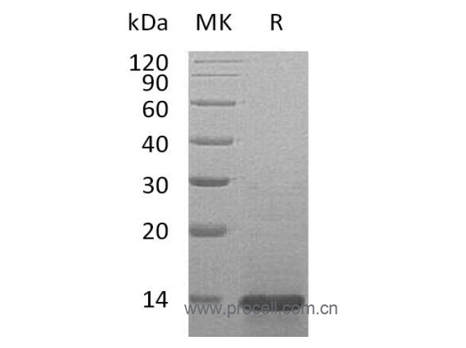 Procell-β-NGF/ NGF/ NGFB (Ser122-Gly241), Mouse, Recombinant