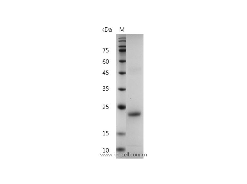 Procell-IL-6/ BSF-2, Human, Recombinant