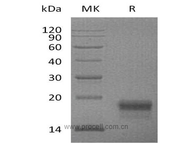 VEGF-D/ FIGF (C-6His), Mouse, Recombinant