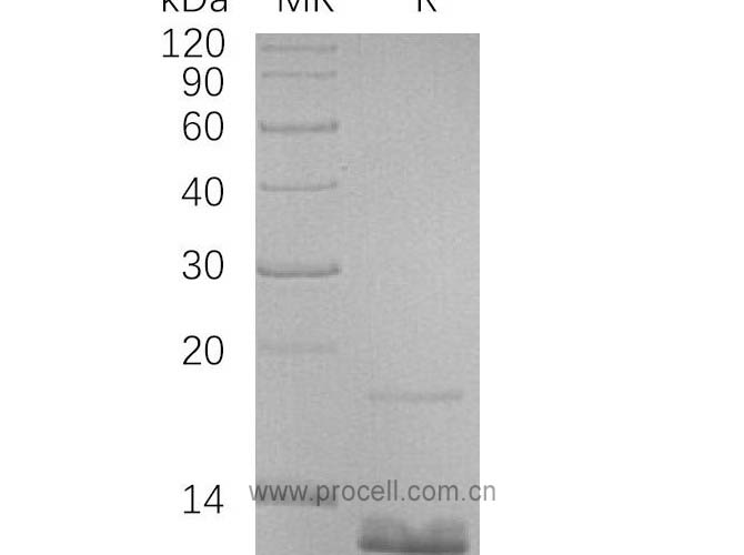 MIP-4/ CCL18 (N-6His), Human, Recombinant