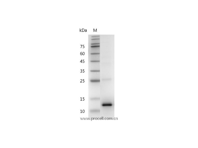 CCL2/MCP-1, Human, Recombinant