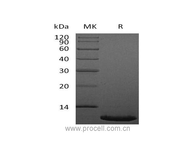 SDF-1α/ SDF-1β/ CXCL12 (22-89), Human, Recombinant