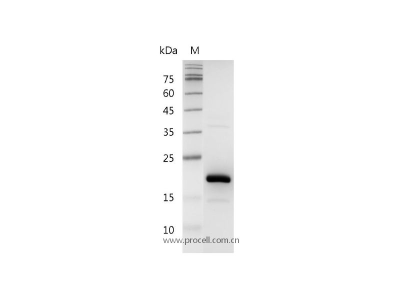FGF-4/ HST, Human, Recombinant
