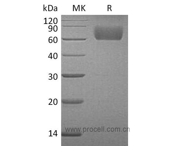 Procell-FGFR-3/ CD333/ FGFR3, Human, Recombinant