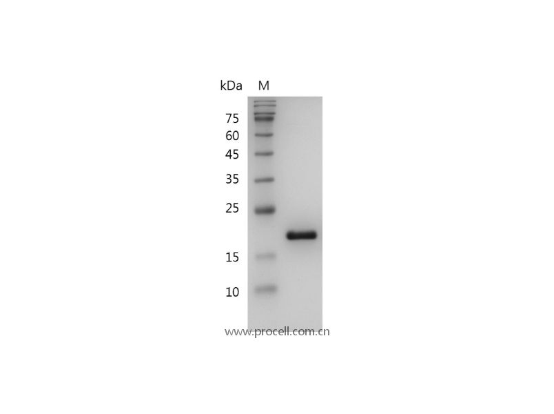 IL-1RA/ IL-1F3, Human, Recombinant