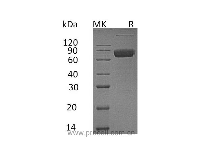 Procell-IL-10RB (C-Fc), Human, Recombinant