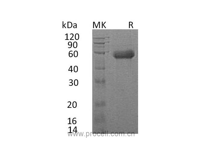 IL-18RAcP/ IL-1R7 (C-6His), Human, Recombinant