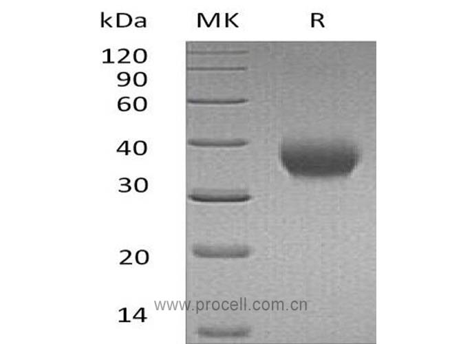 Procell-IL-2RB/ CD122 (C-6His), Human, Recombinant