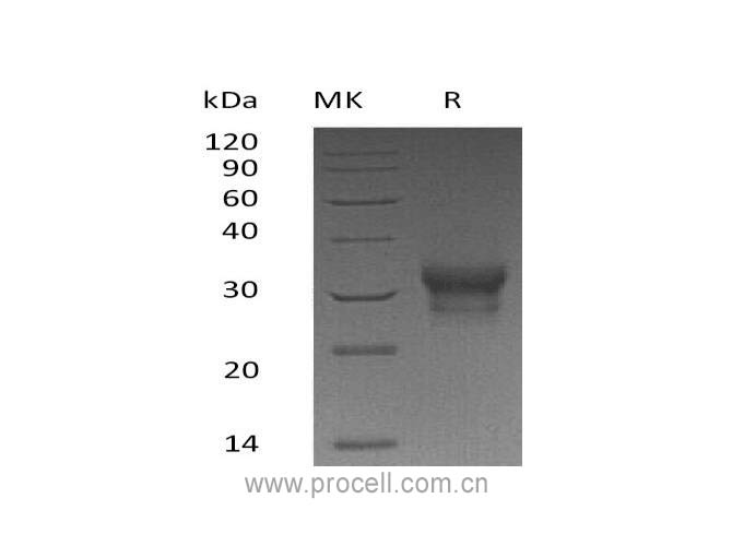 IFN-λ1/ IL-29 (C-10His), Human, Recombinant