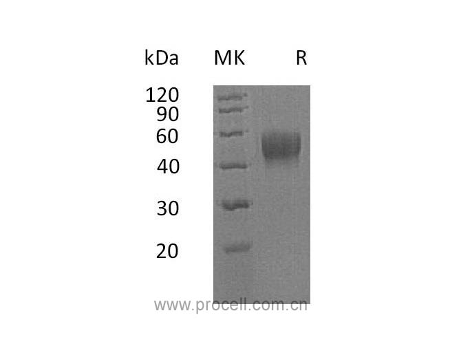 Procell-IL-10RB/ IL-10R2, Human, Recombinant