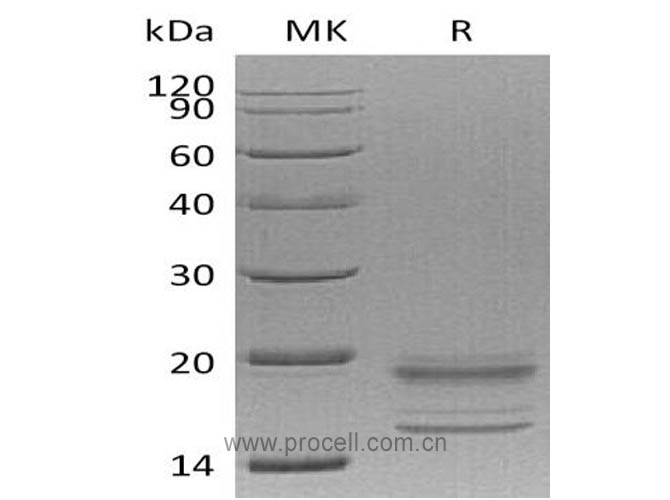 Procell-IL-17A/ F (C-6His), Human, Recombinant