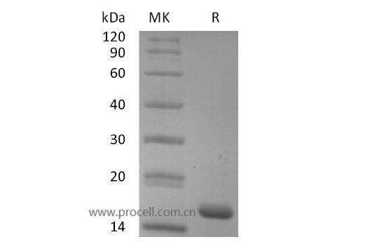 Procell-IL-18/ IL-1F4 (C-6His), Human, Recombinant