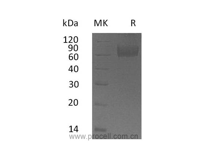 Procell-IL-18BP (C-Fc), Human, Recombinant